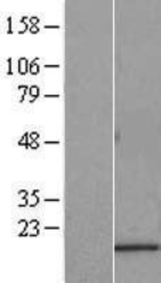 Western Blot: FAM163A Overexpression Lysate (Adult Normal) [NBL1-10490] Left-Empty vector transfected control cell lysate (HEK293 cell lysate); Right -Over-expression Lysate for FAM163A.