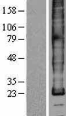 Western Blot: Myelin PLP Overexpression Lysate (Adult Normal) [NBP2-11114] Left-Empty vector transfected control cell lysate (HEK293 cell lysate); Right -Over-expression Lysate for Myelin PLP.