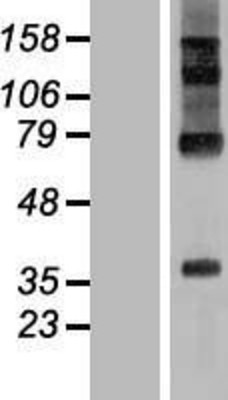 Western Blot: RHBDD2 Overexpression Lysate (Adult Normal) [NBL1-15341] Left-Empty vector transfected control cell lysate (HEK293 cell lysate); Right -Over-expression Lysate for RHBDD2.