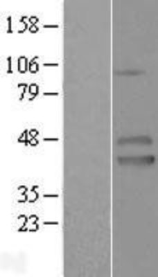 Western Blot: IZUMO1 Overexpression Lysate (Adult Normal) [NBL1-12090] Left-Empty vector transfected control cell lysate (HEK293 cell lysate); Right -Over-expression Lysate for IZUMO1.