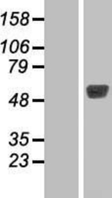 Western Blot: TBL2 Overexpression Lysate (Adult Normal) [NBP2-07440] Left-Empty vector transfected control cell lysate (HEK293 cell lysate); Right -Over-expression Lysate for TBL2.