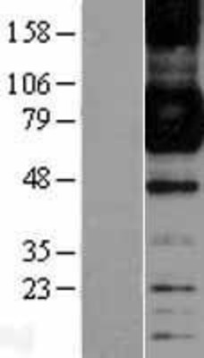 Western Blot: CD64 Overexpression Lysate (Adult Normal) [NBL1-10654] Left-Empty vector transfected control cell lysate (HEK293 cell lysate); Right -Over-expression Lysate for CD64.