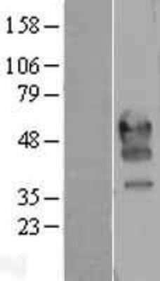 Western Blot: PD1 Overexpression Lysate (Adult Normal) [NBP2-04279] Left-Empty vector transfected control cell lysate (HEK293 cell lysate); Right -Over-expression Lysate for PD1.