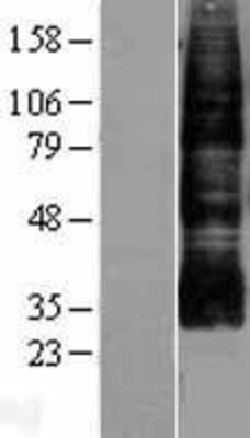 Western Blot: Aquaporin-9 Overexpression Lysate (Adult Normal) [NBL1-07642] Left-Empty vector transfected control cell lysate (HEK293 cell lysate); Right -Over-expression Lysate for Aquaporin-9.