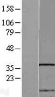 Western Blot: NIP30 Overexpression Lysate (Adult Normal) [NBL1-13643] Left-Empty vector transfected control cell lysate (HEK293 cell lysate); Right -Over-expression Lysate for NIP30.