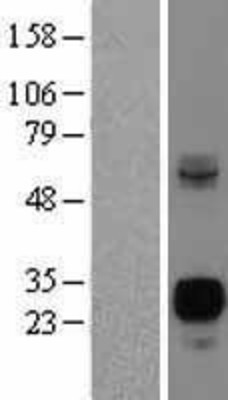 Western Blot: Neurogenin3 Overexpression Lysate (Adult Normal) [NBL1-13604] Left-Empty vector transfected control cell lysate (HEK293 cell lysate); Right -Over-expression Lysate for Neurogenin3.