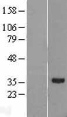 Western Blot: RDH11 Overexpression Lysate (Adult Normal) [NBL1-15255] Left-Empty vector transfected control cell lysate (HEK293 cell lysate); Right -Over-expression Lysate for RDH11.