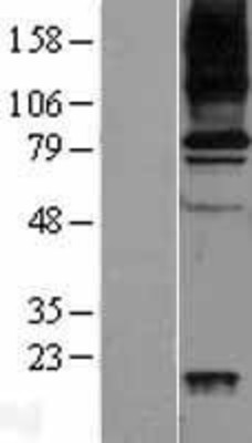 Western Blot: VAP1 Overexpression Lysate (Adult Normal) [NBP2-04256] Left-Empty vector transfected control cell lysate (HEK293 cell lysate); Right -Over-expression Lysate for VAP1.