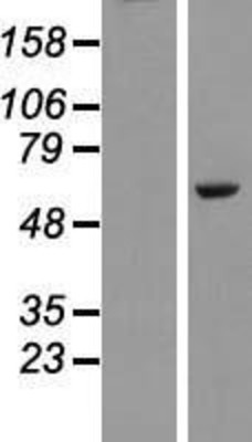 Western Blot: PLAG1 Overexpression Lysate (Adult Normal) [NBL1-14483] Left-Empty vector transfected control cell lysate (HEK293 cell lysate); Right -Over-expression Lysate for PLAG1.