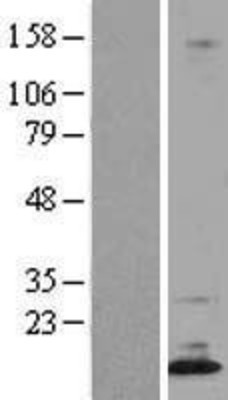 Western Blot: Dppa5 Overexpression Lysate (Adult Normal) [NBL1-10004] Left-Empty vector transfected control cell lysate (HEK293 cell lysate); Right -Over-expression Lysate for Dppa5.