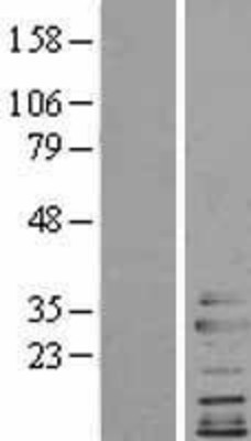 Western Blot: Clathrin light chain Overexpression Lysate (Adult Normal) [NBL1-09287] Left-Empty vector transfected control cell lysate (HEK293 cell lysate); Right -Over-expression Lysate for Clathrin light chain.
