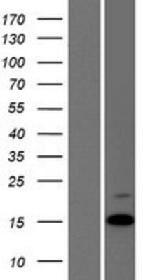 Western Blot: Arg-vasopressin Overexpression Lysate (Adult Normal) [NBP2-10674] Left-Empty vector transfected control cell lysate (HEK293 cell lysate); Right -Over-expression Lysate for Arg-vasopressin.
