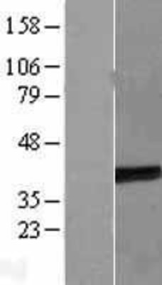 Western Blot: ETV7 Overexpression Lysate (Adult Normal) [NBL1-10363] Left-Empty vector transfected control cell lysate (HEK293 cell lysate); Right -Over-expression Lysate for ETV7.