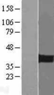 Western Blot: PITX2 Overexpression Lysate (Adult Normal) [NBL1-14446] Left-Empty vector transfected control cell lysate (HEK293 cell lysate); Right -Over-expression Lysate for PITX2.