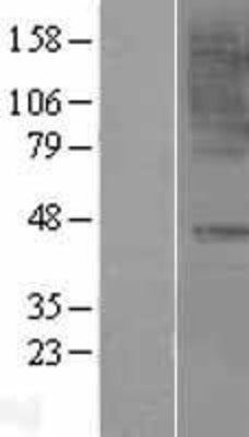 Western Blot: CCR6 Overexpression Lysate (Adult Normal) [NBL1-08894] Left-Empty vector transfected control cell lysate (HEK293 cell lysate); Right -Over-expression Lysate for CCR6.