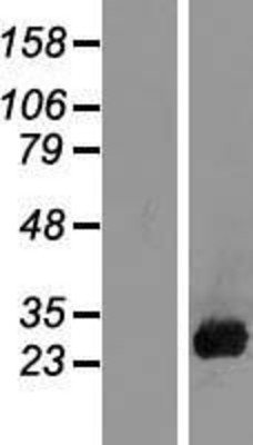 Western Blot: PLACENTAL LACTOGEN Overexpression Lysate (Adult Normal) [NBL1-09522] Left-Empty vector transfected control cell lysate (HEK293 cell lysate); Right -Over-expression Lysate for PLACENTAL LACTOGEN.