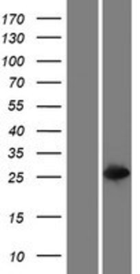 Western Blot: GSTT2 Overexpression Lysate (Adult Normal) [NBP2-10660] Left-Empty vector transfected control cell lysate (HEK293 cell lysate); Right -Over-expression Lysate for GSTT2.