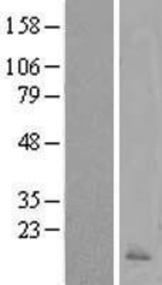 Western Blot: Calcitonin Overexpression Lysate (Adult Normal) [NBP2-11205] Left-Empty vector transfected control cell lysate (HEK293 cell lysate); Right -Over-expression Lysate for Calcitonin.