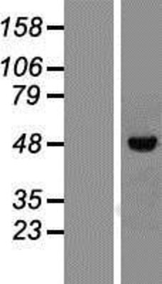 Western Blot: Vitamin D Receptor Overexpression Lysate (Adult Normal) [NBP2-11216] Left-Empty vector transfected control cell lysate (HEK293 cell lysate); Right -Over-expression Lysate for Vitamin D Receptor.