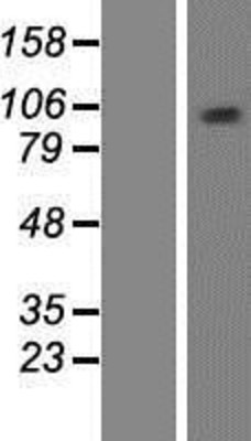 Western Blot: MCM10 Overexpression Lysate (Adult Normal) [NBP2-10059] Left-Empty vector transfected control cell lysate (HEK293 cell lysate); Right -Over-expression Lysate for MCM10.