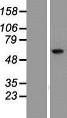 Western Blot: RIOK1 Overexpression Lysate (Adult Normal) [NBP2-09925] Left-Empty vector transfected control cell lysate (HEK293 cell lysate); Right -Over-expression Lysate for RIOK1.