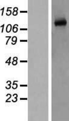 Western Blot: eNOS Overexpression Lysate (Adult Normal) [NBP2-10685] Left-Empty vector transfected control cell lysate (HEK293 cell lysate); Right -Over-expression Lysate for eNOS.