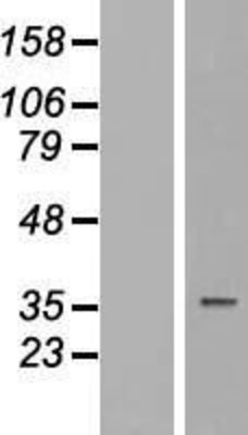 Western Blot: TUSC3 Overexpression Lysate (Adult Normal) [NBP2-09836] Left-Empty vector transfected control cell lysate (HEK293 cell lysate); Right -Over-expression Lysate for TUSC3.
