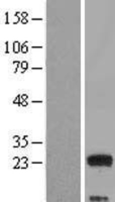 Western Blot: MED9 Overexpression Lysate (Adult Normal) [NBL1-12997] Left-Empty vector transfected control cell lysate (HEK293 cell lysate); Right -Over-expression Lysate for MED9.