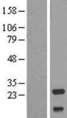 Western Blot: NDUFV2 Overexpression Lysate (Adult Normal) [NBL1-13567] Left-Empty vector transfected control cell lysate (HEK293 cell lysate); Right -Over-expression Lysate for NDUFV2.