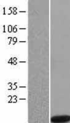 Western Blot: Noxa Overexpression Lysate (Adult Normal) [NBL1-14534] Left-Empty vector transfected control cell lysate (HEK293 cell lysate); Right -Over-expression Lysate for Noxa.