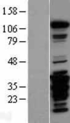 Western Blot: FAK Overexpression Lysate (Adult Normal) [NBL1-14951] Left-Empty vector transfected control cell lysate (HEK293 cell lysate); Right -Over-expression Lysate for FAK.