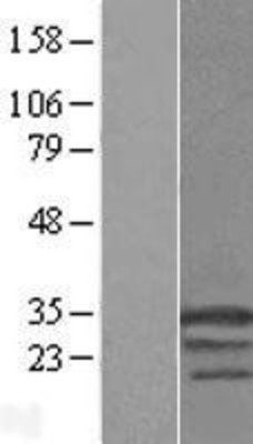 Western Blot: Hsp22 Overexpression Lysate (Adult Normal) [NBL1-11761] Left-Empty vector transfected control cell lysate (HEK293 cell lysate); Right -Over-expression Lysate for Hsp22.