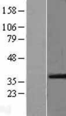 Western Blot: VEGFA Overexpression Lysate (Adult Normal) [NBL1-17712] Left-Empty vector transfected control cell lysate (HEK293 cell lysate); Right -Over-expression Lysate for VEGFA.