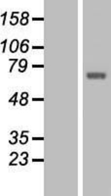 Western Blot: TCTN1 Overexpression Lysate (Adult Normal) [NBL1-16793] Left-Empty vector transfected control cell lysate (HEK293 cell lysate); Right -Over-expression Lysate for TCTN1.