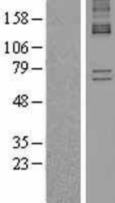 Western Blot: Alas1 Overexpression Lysate (Adult Normal) [NBL1-07446] Left-Empty vector transfected control cell lysate (HEK293 cell lysate); Right -Over-expression Lysate for Alas1.