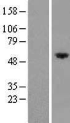 Western Blot: FRMD8 Overexpression Lysate (Adult Normal) [NBL1-10835] Left-Empty vector transfected control cell lysate (HEK293 cell lysate); Right -Over-expression Lysate for FRMD8.