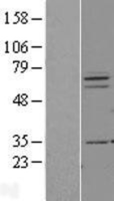 Western Blot: PIAS3 Overexpression Lysate (Adult Normal) [NBL1-14387] Left-Empty vector transfected control cell lysate (HEK293 cell lysate); Right -Over-expression Lysate for PIAS3.