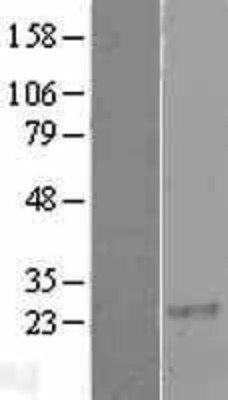 Western Blot: RGS8 Overexpression Lysate (Adult Normal) [NBL1-15338] Left-Empty vector transfected control cell lysate (HEK293 cell lysate); Right -Over-expression Lysate for RGS8.