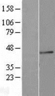 Western Blot: Blood Group Lewis b Overexpression Lysate (Adult Normal) [NBL1-10865] Left-Empty vector transfected control cell lysate (HEK293 cell lysate); Right -Over-expression Lysate for Blood Group Lewis b.