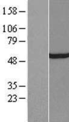 Western Blot: TFIIE-alpha Overexpression Lysate (Adult Normal) [NBP2-10463] Left-Empty vector transfected control cell lysate (HEK293 cell lysate); Right -Over-expression Lysate for TFIIE-alpha.