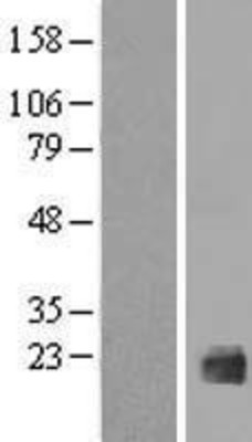 Western Blot: IL1F10 Overexpression Lysate (Adult Normal) [NBP2-10023] Left-Empty vector transfected control cell lysate (HEK293 cell lysate); Right -Over-expression Lysate for IL1F10.