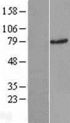 Western Blot: Rad17 Overexpression Lysate (Adult Normal) [NBP2-09966] Left-Empty vector transfected control cell lysate (HEK293 cell lysate); Right -Over-expression Lysate for Rad17.