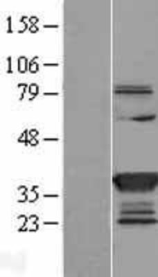 Western Blot: SULT1C2 Overexpression Lysate (Adult Normal) [NBL1-16605] Left-Empty vector transfected control cell lysate (HEK293 cell lysate); Right -Over-expression Lysate for SULT1C2.