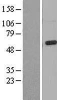 Western Blot: Mucolipin 3 Overexpression Lysate (Adult Normal) [NBL1-12960] Left-Empty vector transfected control cell lysate (HEK293 cell lysate); Right -Over-expression Lysate for Mucolipin 3.