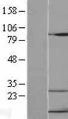 Western Blot: CXCL10/INP10 Overexpression Lysate (Adult Normal) [NBL1-09621] Left-Empty vector transfected control cell lysate (HEK293 cell lysate); Right -Over-expression Lysate for CXCL10/INP10.