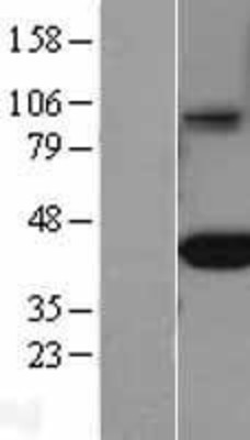 Western Blot: FCGRT Overexpression Lysate (Adult Normal) [NBL1-10660] Left-Empty vector transfected control cell lysate (HEK293 cell lysate); Right -Over-expression Lysate for FCGRT.