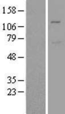 Western Blot: Mib1/Mindbomb Overexpression Lysate (Adult Normal) [NBL1-13097] Left-Empty vector transfected control cell lysate (HEK293 cell lysate); Right -Over-expression Lysate for Mib1/Mindbomb.