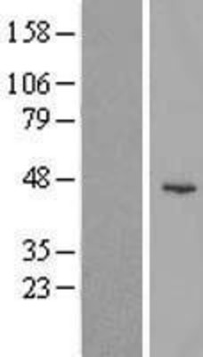 Western Blot: KLHDC1 Overexpression Lysate (Adult Normal) [NBL1-12324] Left-Empty vector transfected control cell lysate (HEK293 cell lysate); Right -Over-expression Lysate for KLHDC1.