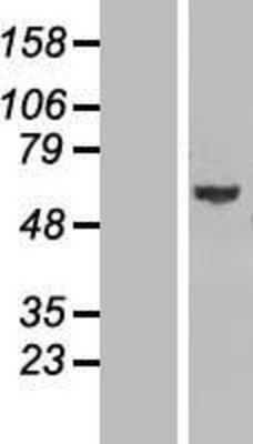 Western Blot: GLMN Overexpression Lysate (Adult Normal) [NBL1-11116] Left-Empty vector transfected control cell lysate (HEK293 cell lysate); Right -Over-expression Lysate for GLMN.