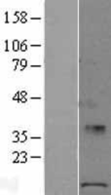 Western Blot: POLR1D Overexpression Lysate (Adult Normal) [NBL1-14577] Left-Empty vector transfected control cell lysate (HEK293 cell lysate); Right -Over-expression Lysate for POLR1D.